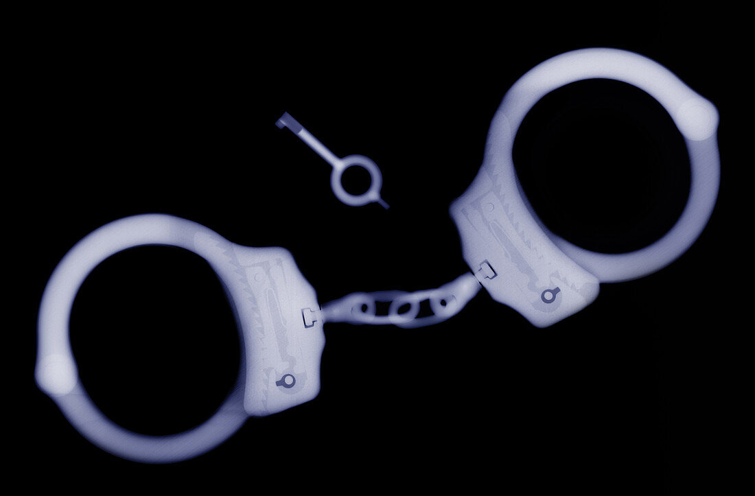 X-ray of Handcuffs and Keys