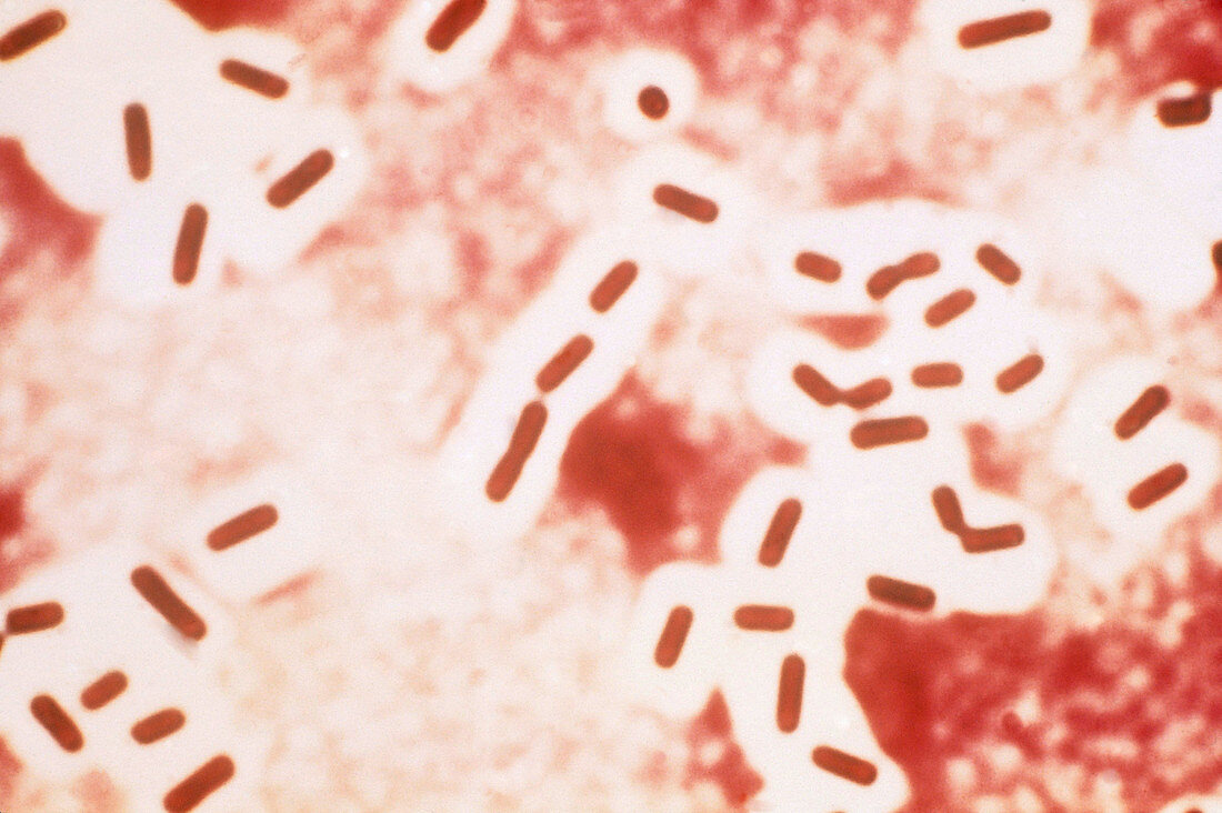 Clostridium perfringens,LM
