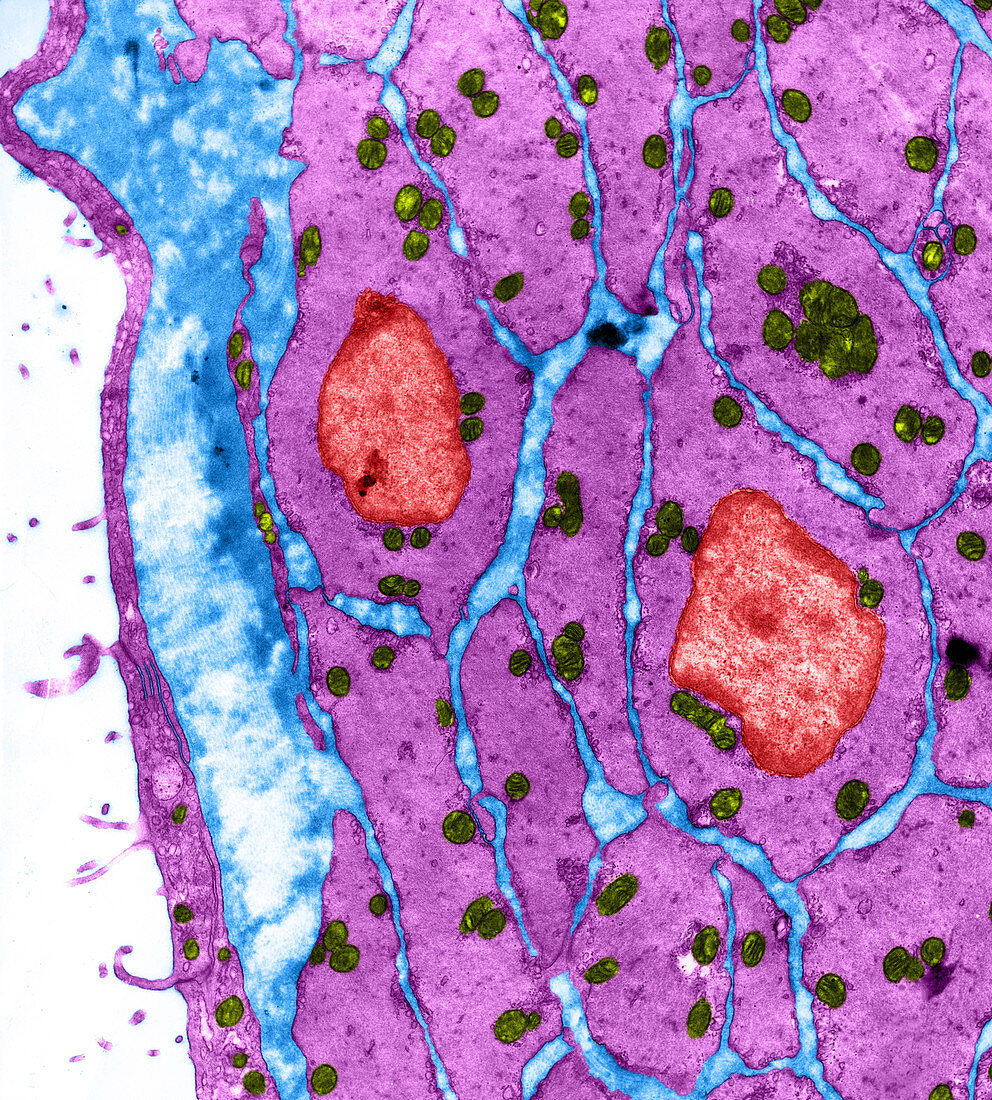 Liver cells,TEM