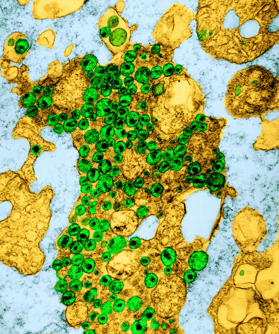 Human T-lymphocyte Showing HIV
