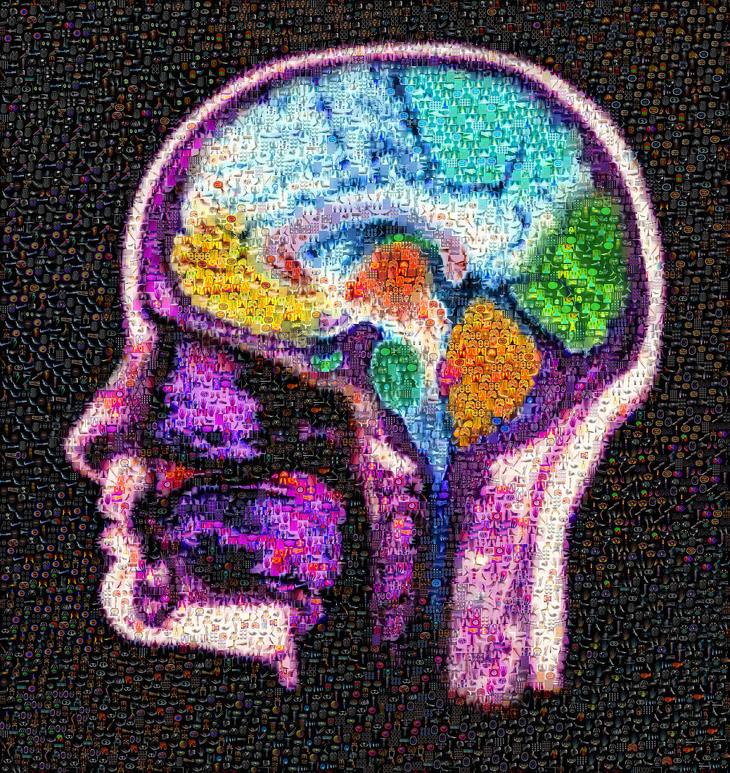 Mosaic of Brain MRI