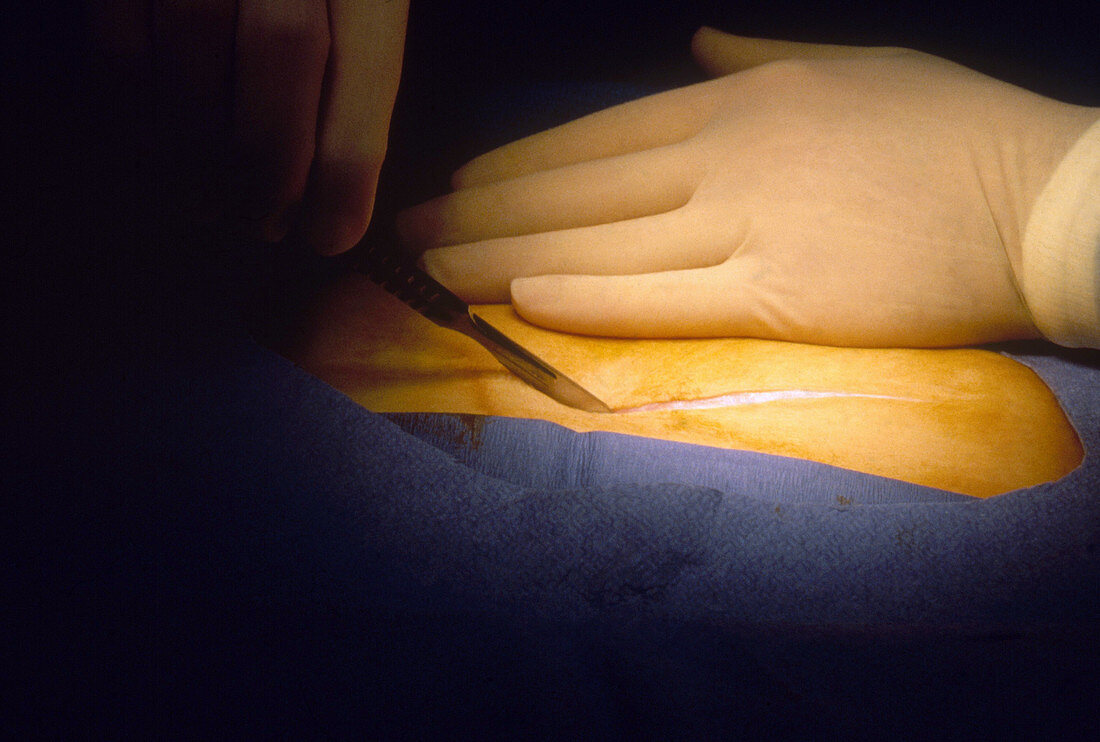 Surgeon Making Incision