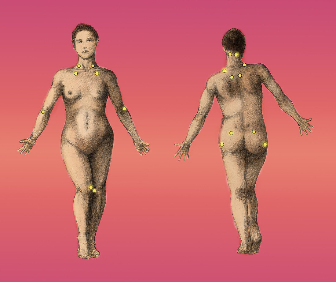 Pressure Points,Female