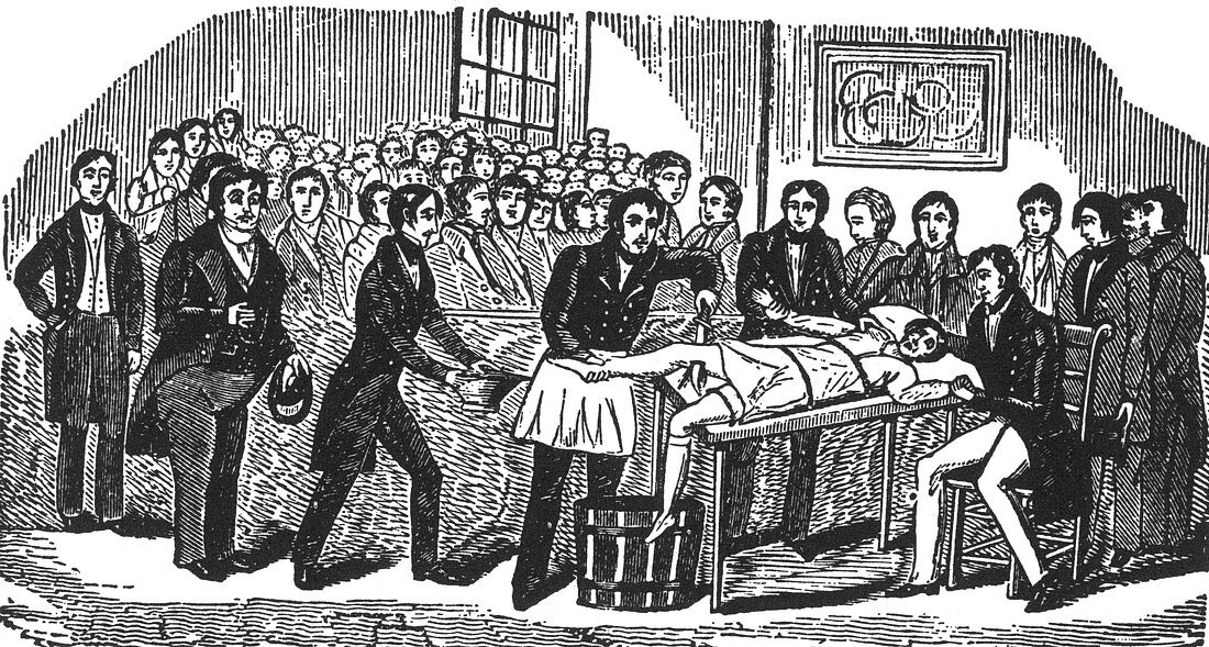 Surgery Without Anesthesia,pre-1840's