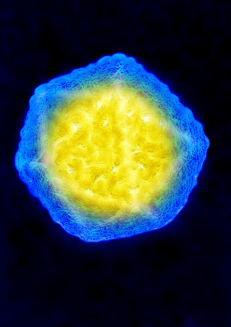 TEM of Hepatitis A Virus