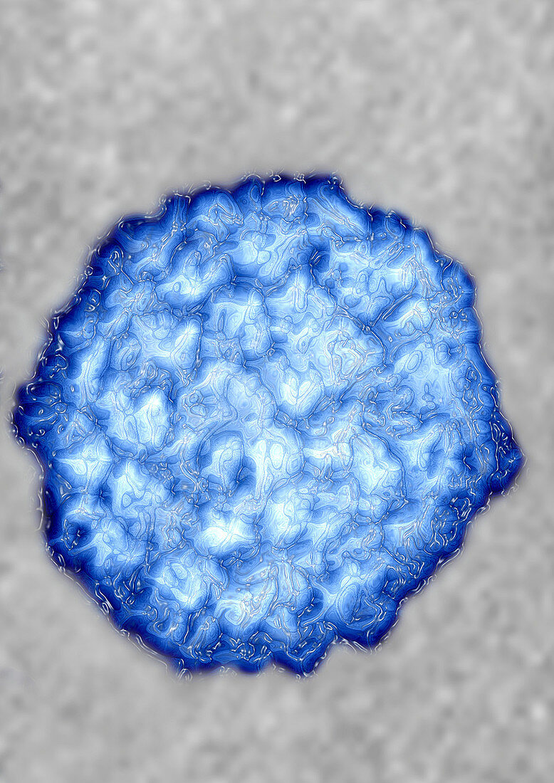 TEM of HPV