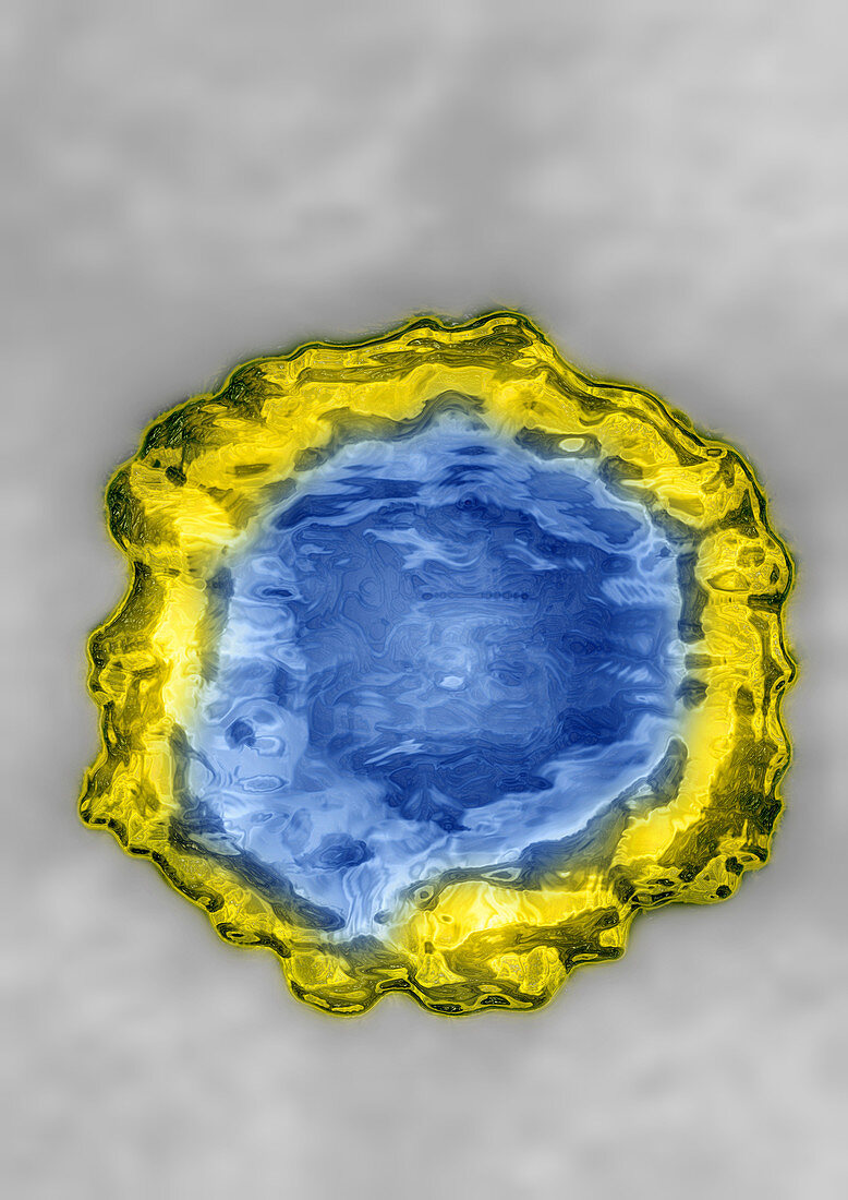 TEM of Rubivirus