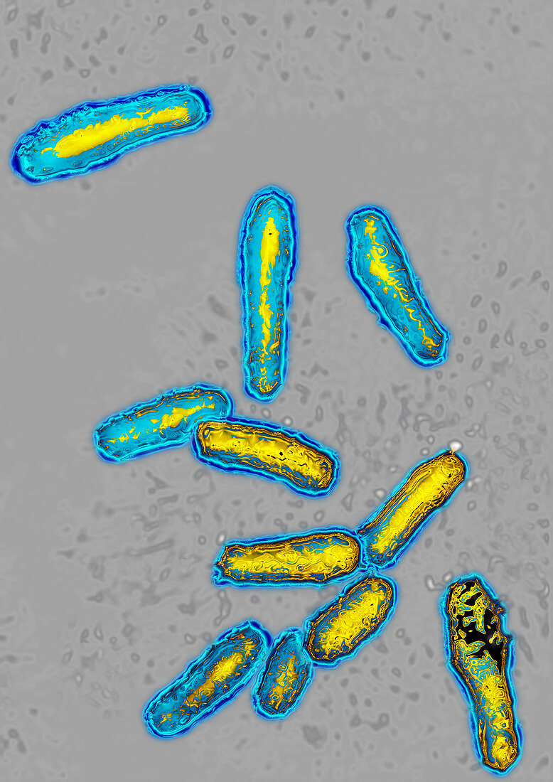 Botulism bacteria,TEM