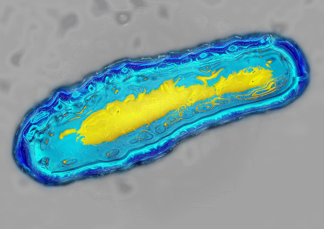 Botulism bacterium,TEM