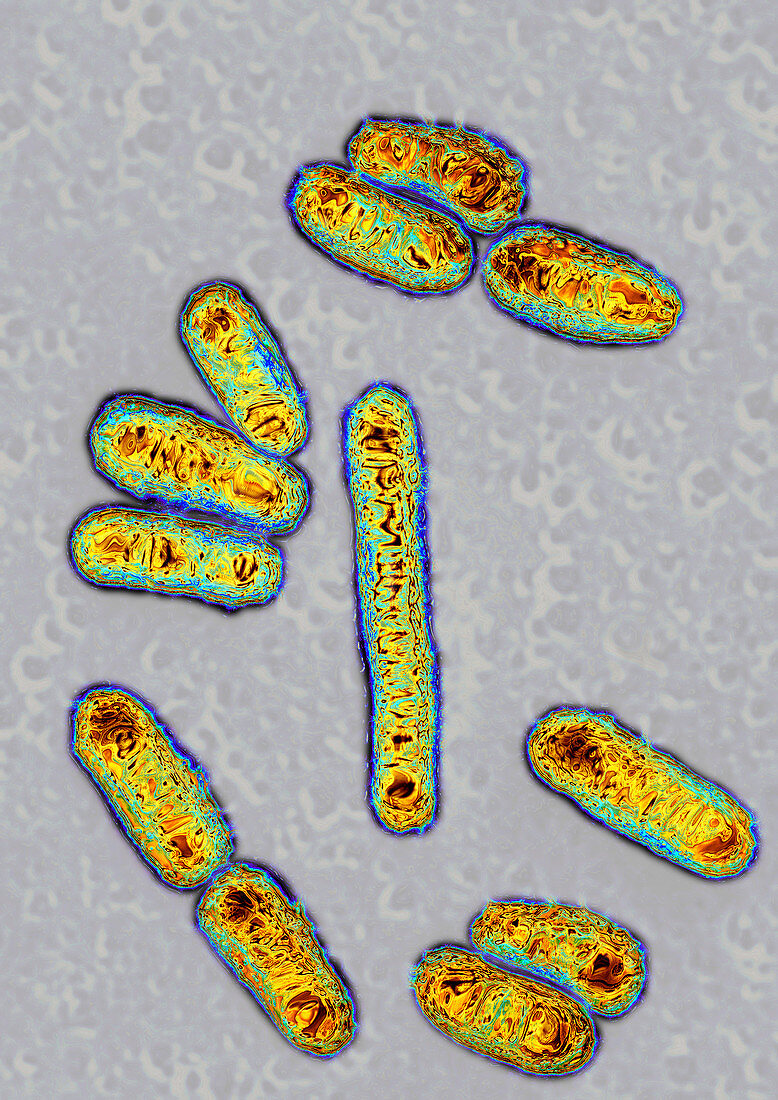 Escherichia coli bacteria,TEM