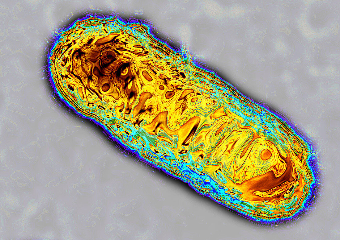Escherichia coli bacterium,TEM