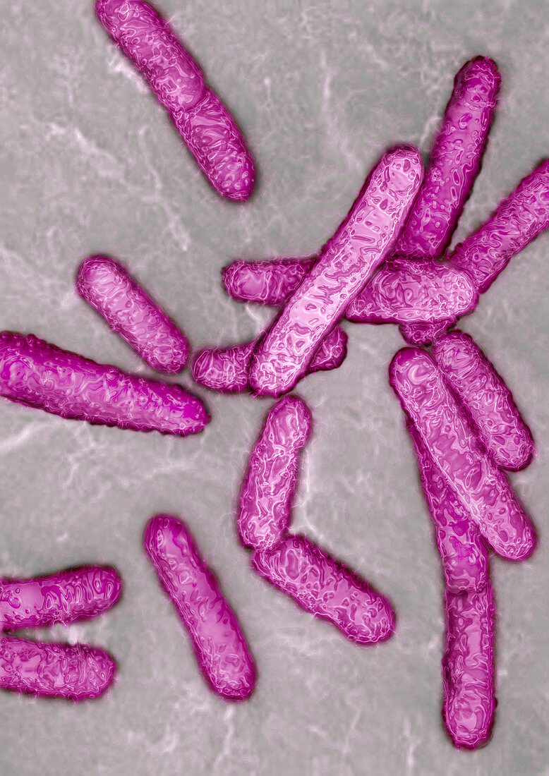 Listeria bacteria,TEM
