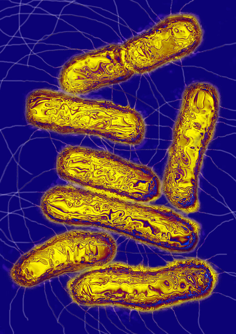 Salmonella bacteria,TEM