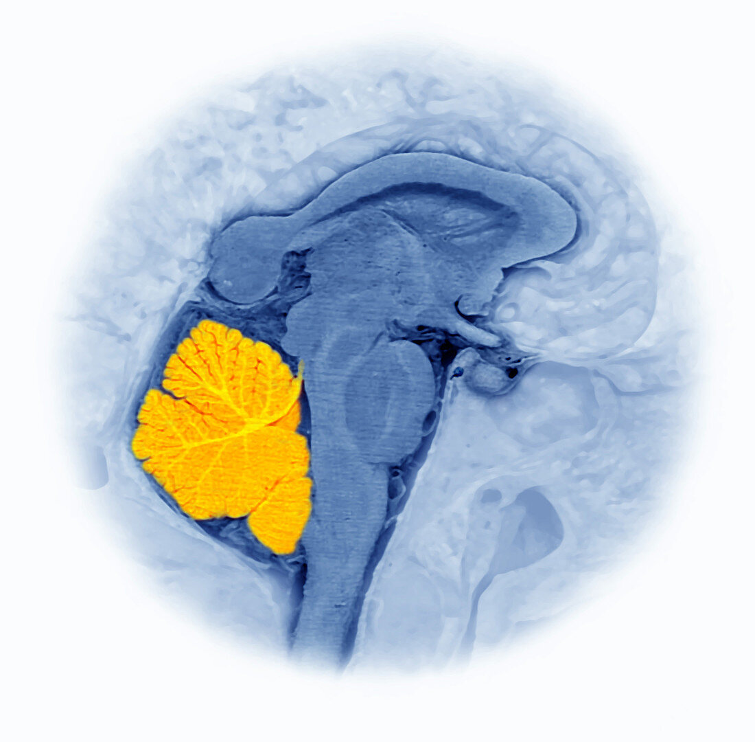 Cerebellum