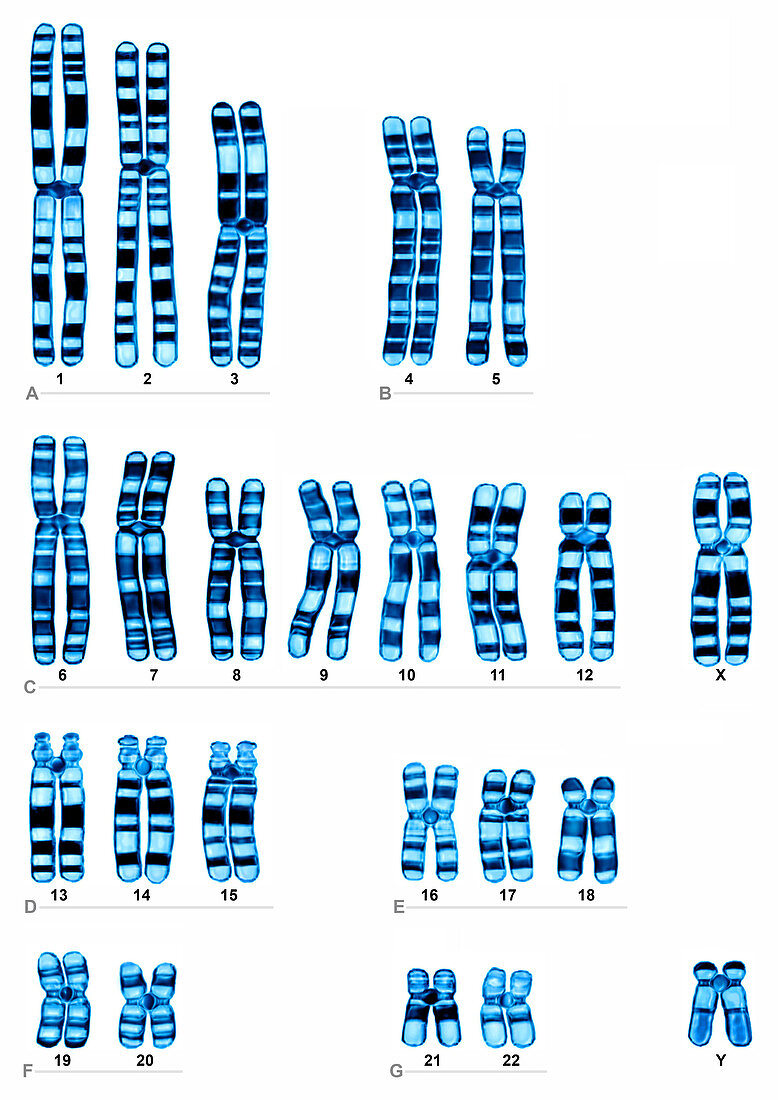 Human Karyotype