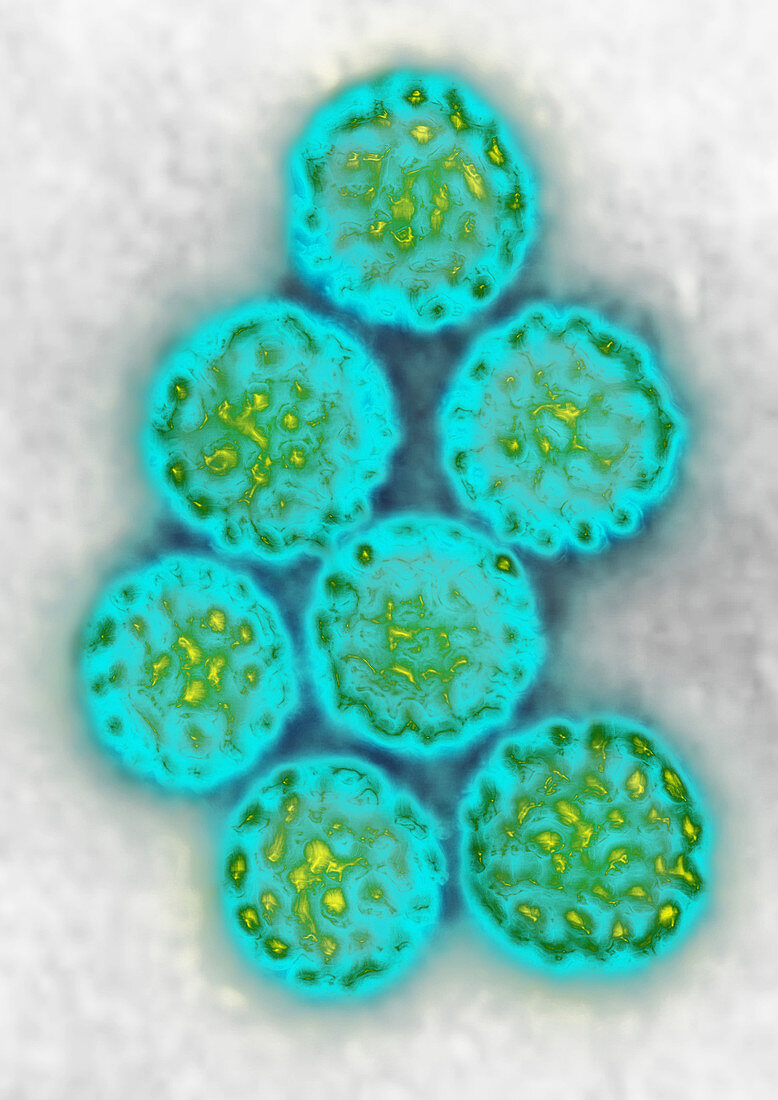 TEM of Polyomavirus