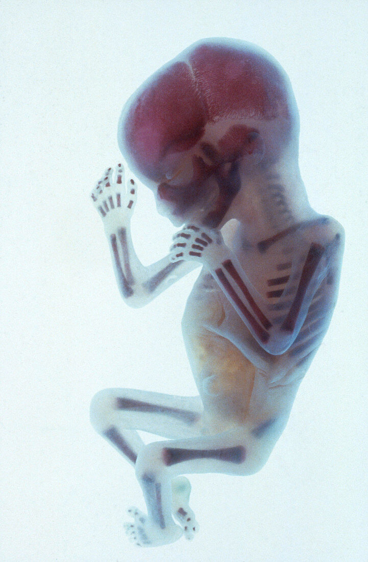 Human Fetus at 24 Weeks
