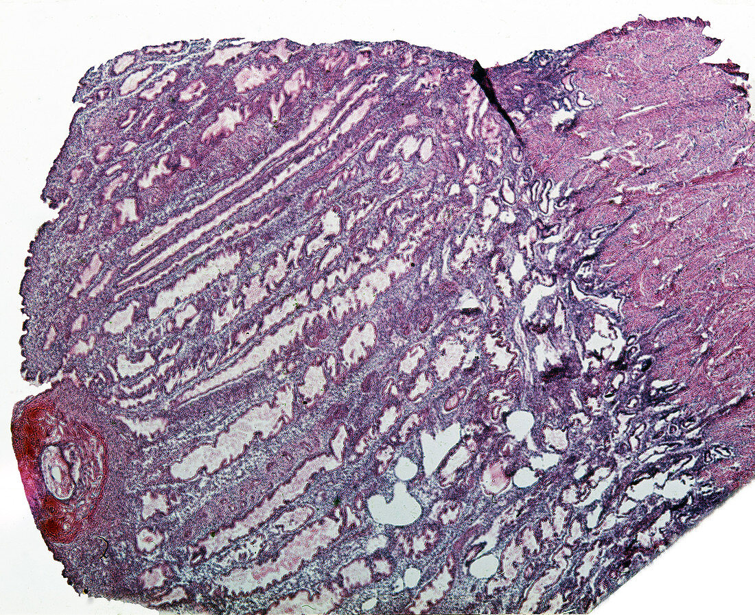 LS of Uterus with Implanted Ovum