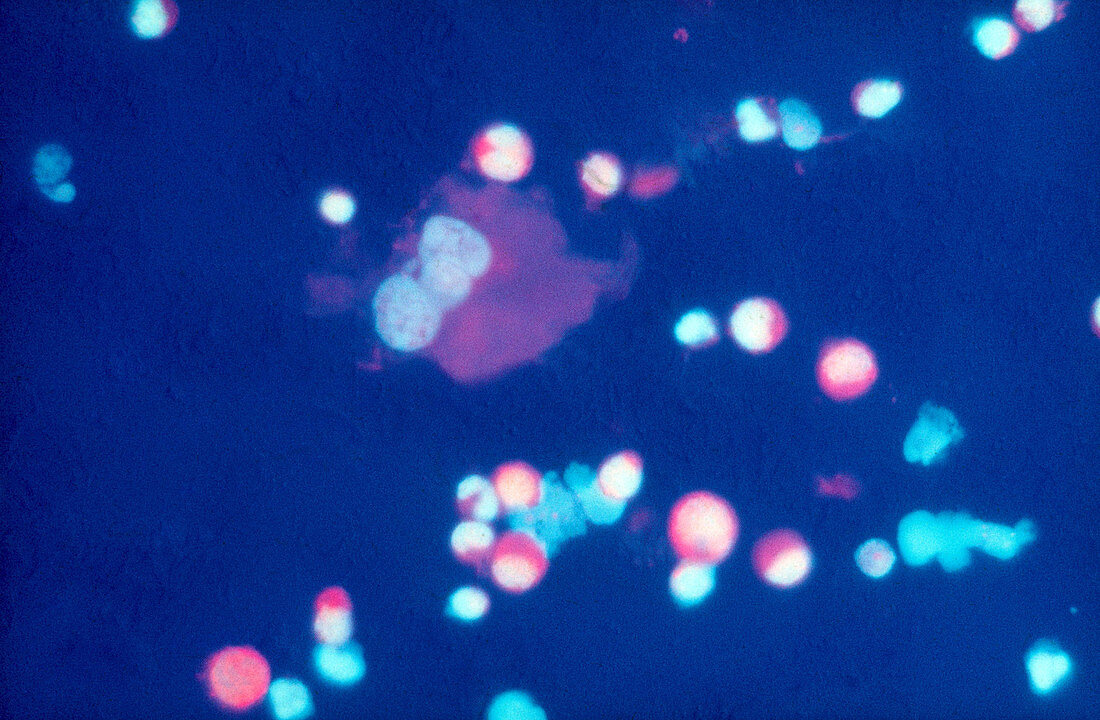 Immunofluorescence of Human Sperm
