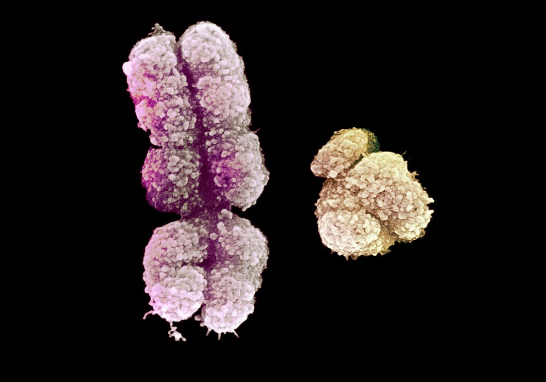 Human X and Y chromosomes,SEM