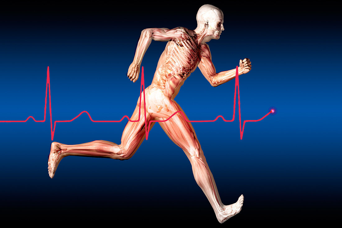 Anatomical Runner with Normal EKG