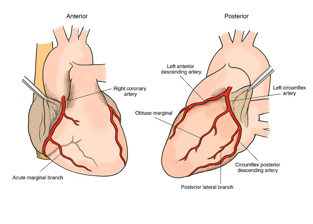 Illustration of Coronary Arteries