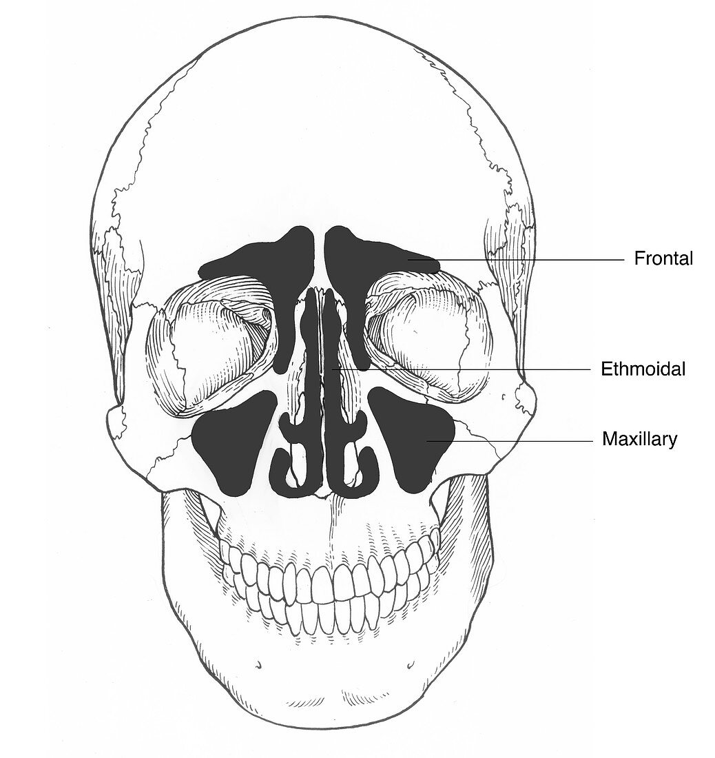 Illustration of Sinus Cavities