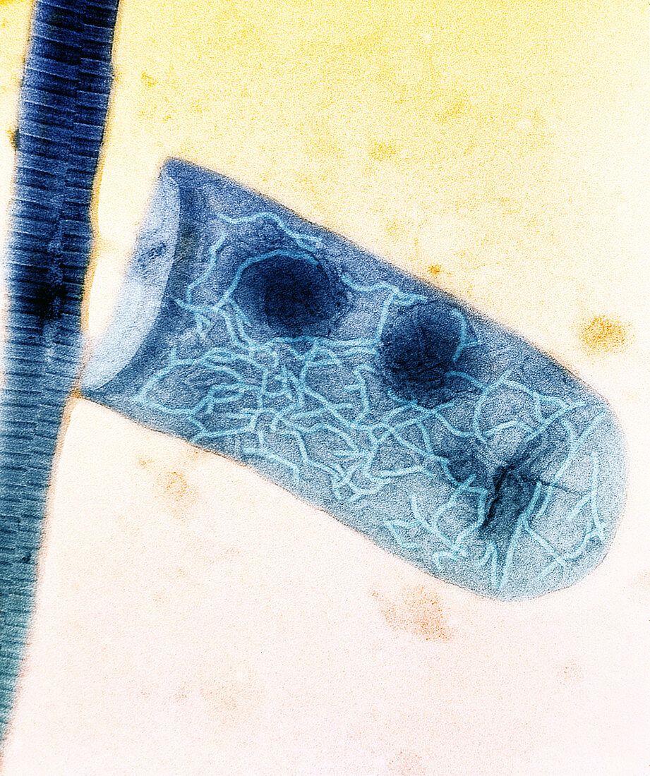 Mycobacterium leprae,TEM
