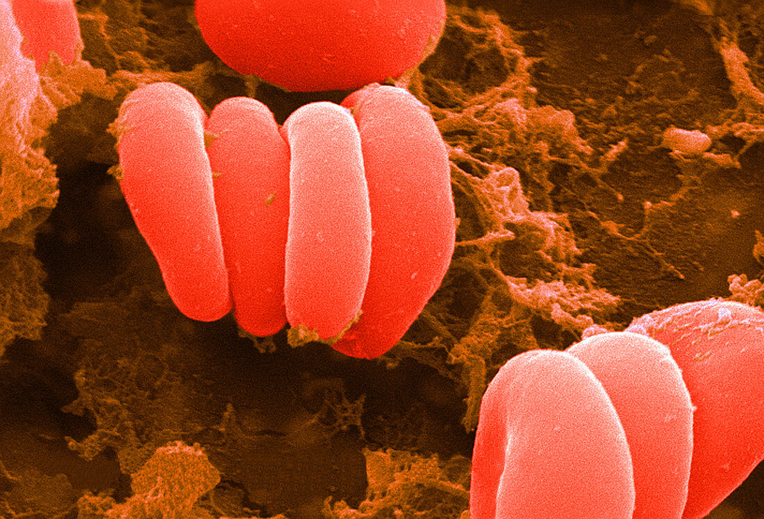 Red Blood Cells,Rouleaux Formation,SEM