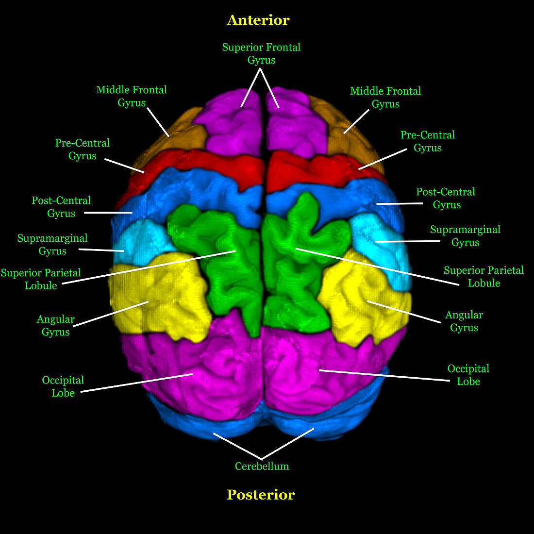 Labelled MRI of Normal Brain