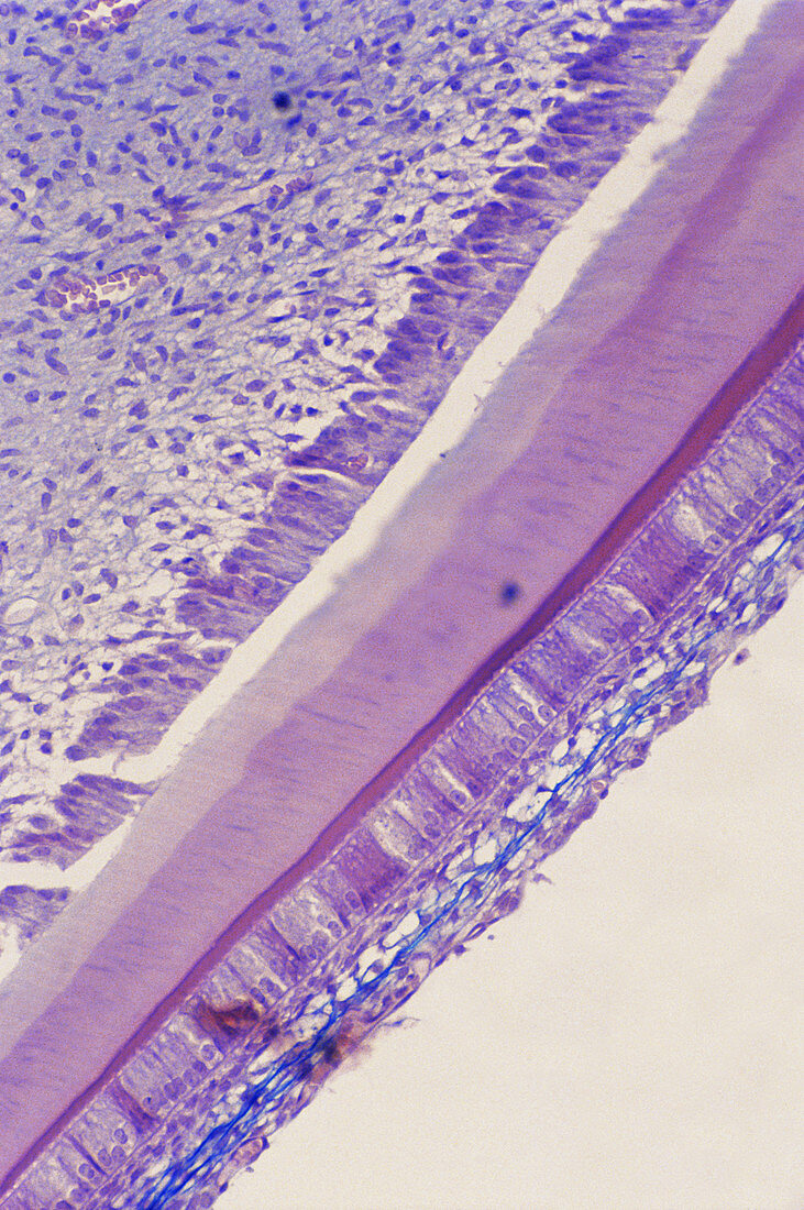 Ameloblasts,LM