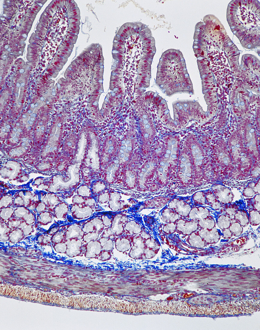 Human Duodenum,LM