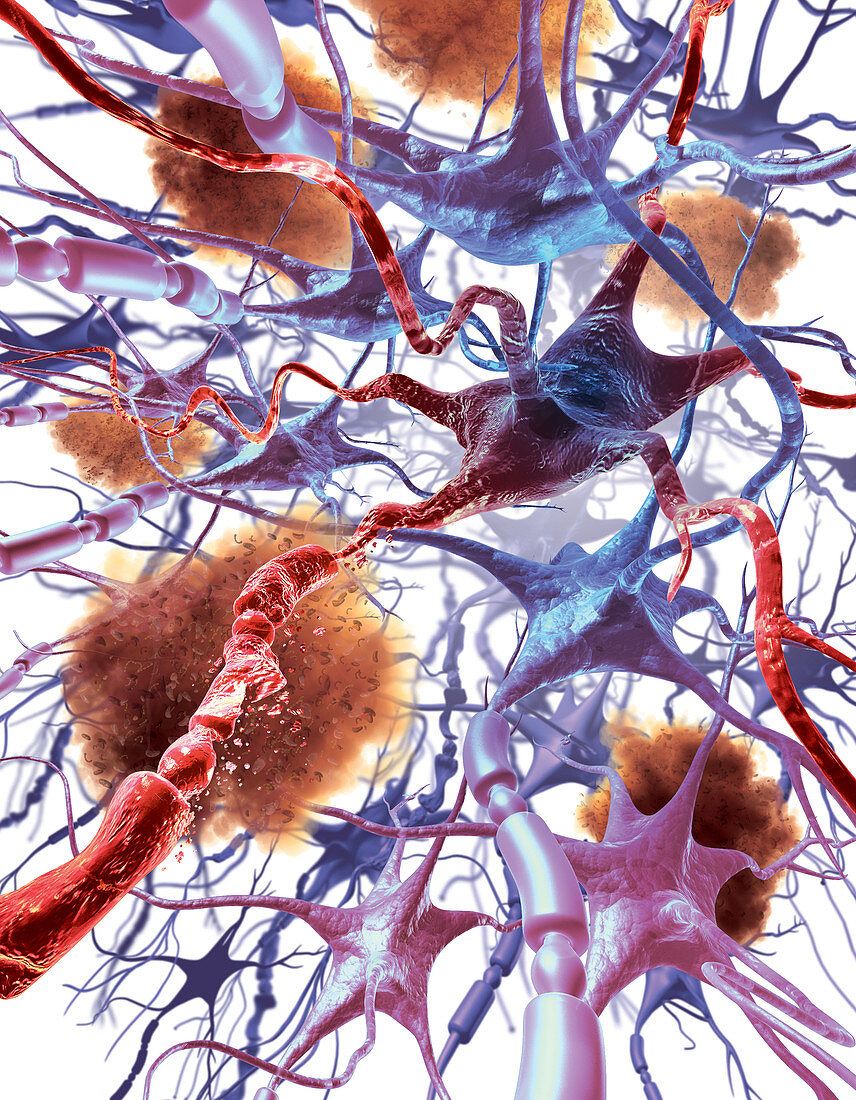 Neuronal Apoptosis In Alzheimer's Disease