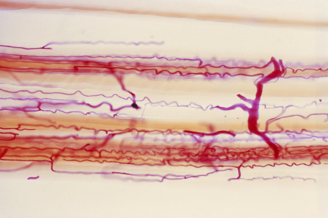 Blood Supply to Muscles,LM