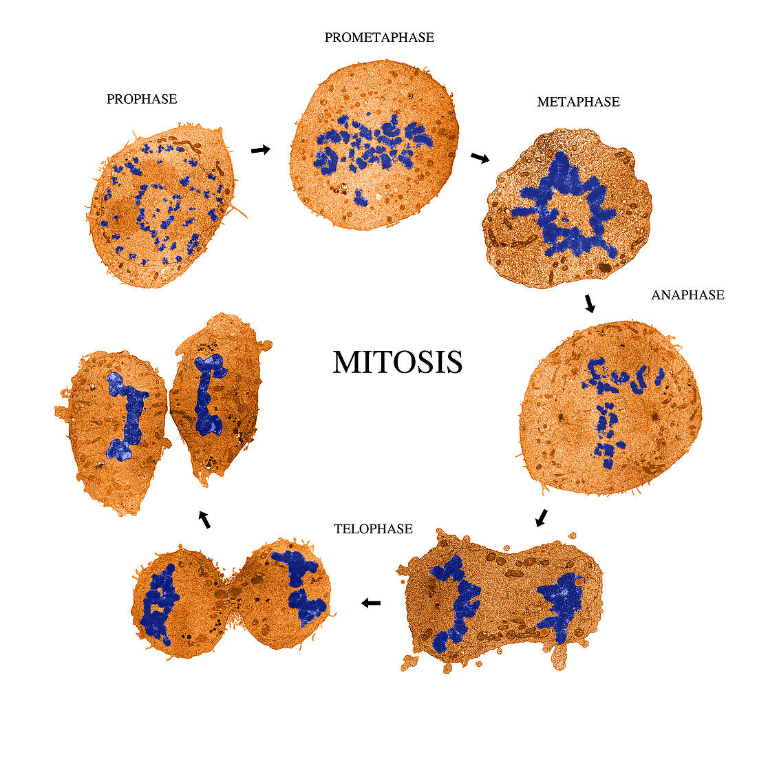 Stages of Mitosis,TEM