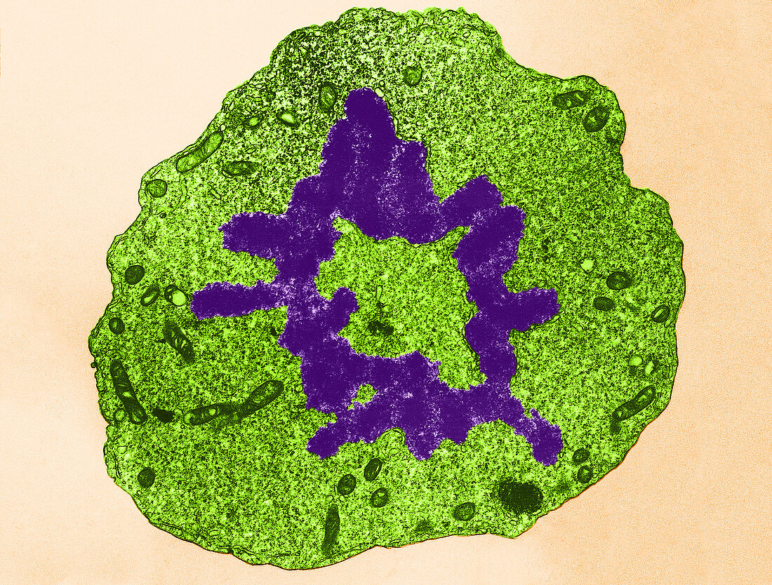 Mitosis,Metaphase,TEM