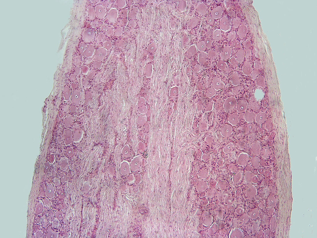 Spinal root ganglion,dog