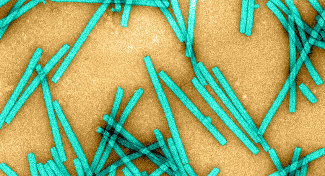 Tobacco Mosaic Virus,TEM