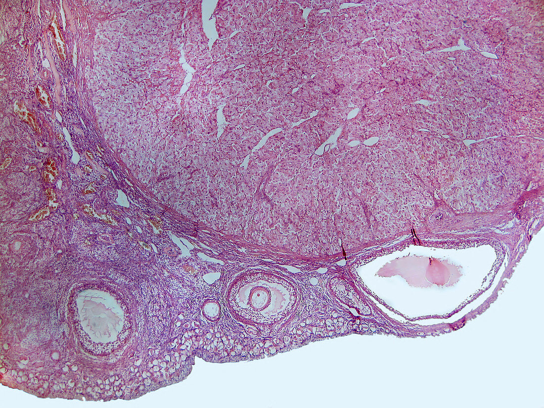 Ovarian Follicles and Corpus Luteum,LM