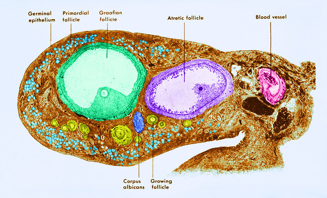 Ovary and Fallopian Tube