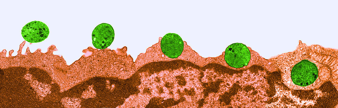 Theileria Infecting Bovine Lymphocyte