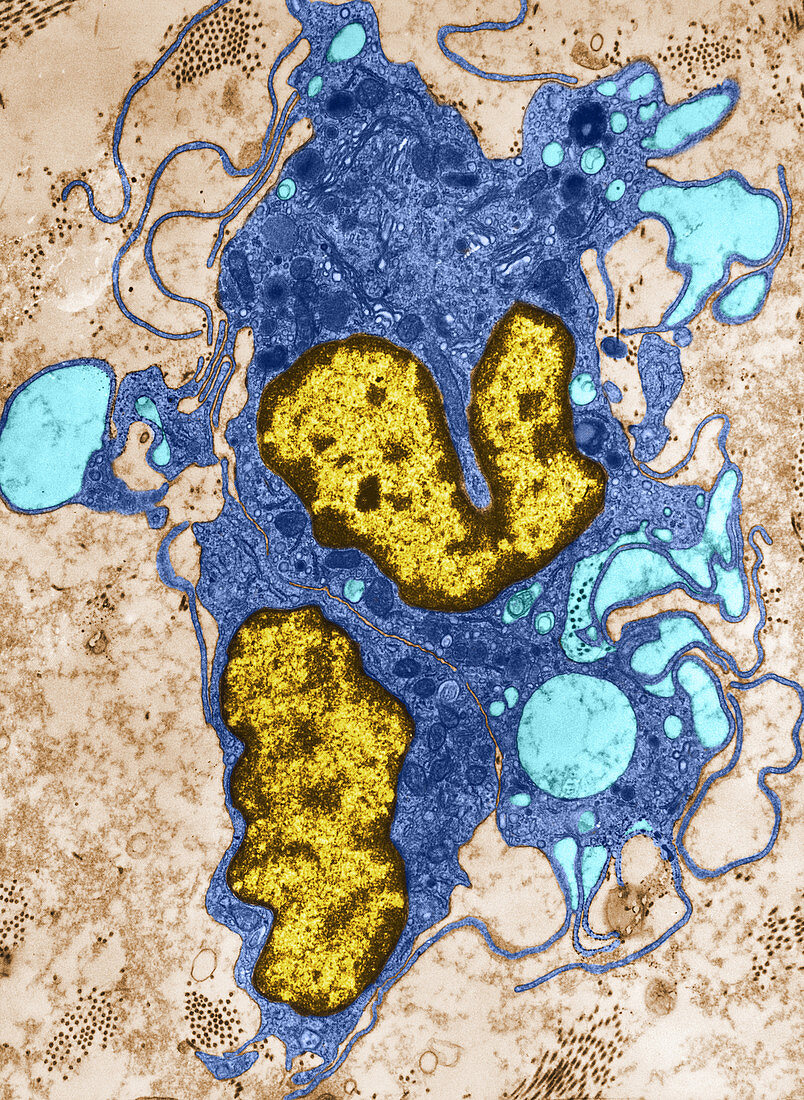 Pinocytosis,TEM