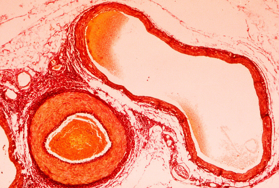 Artery and vein,light micrograph