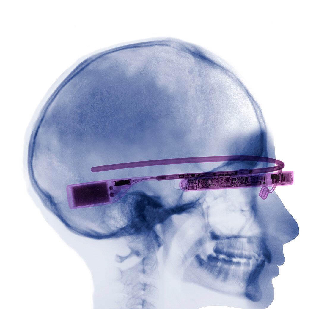 Google Glass,X-ray