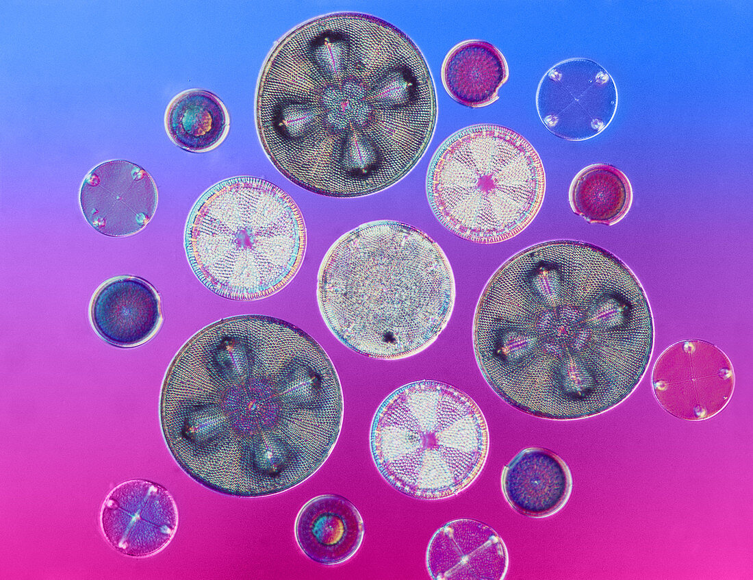 Centric Diatoms