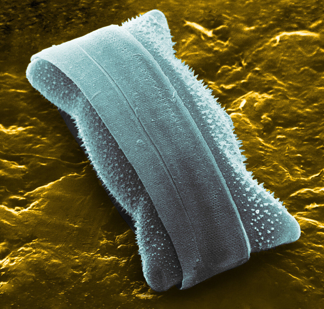 Diatom (Biddulphia sp.)