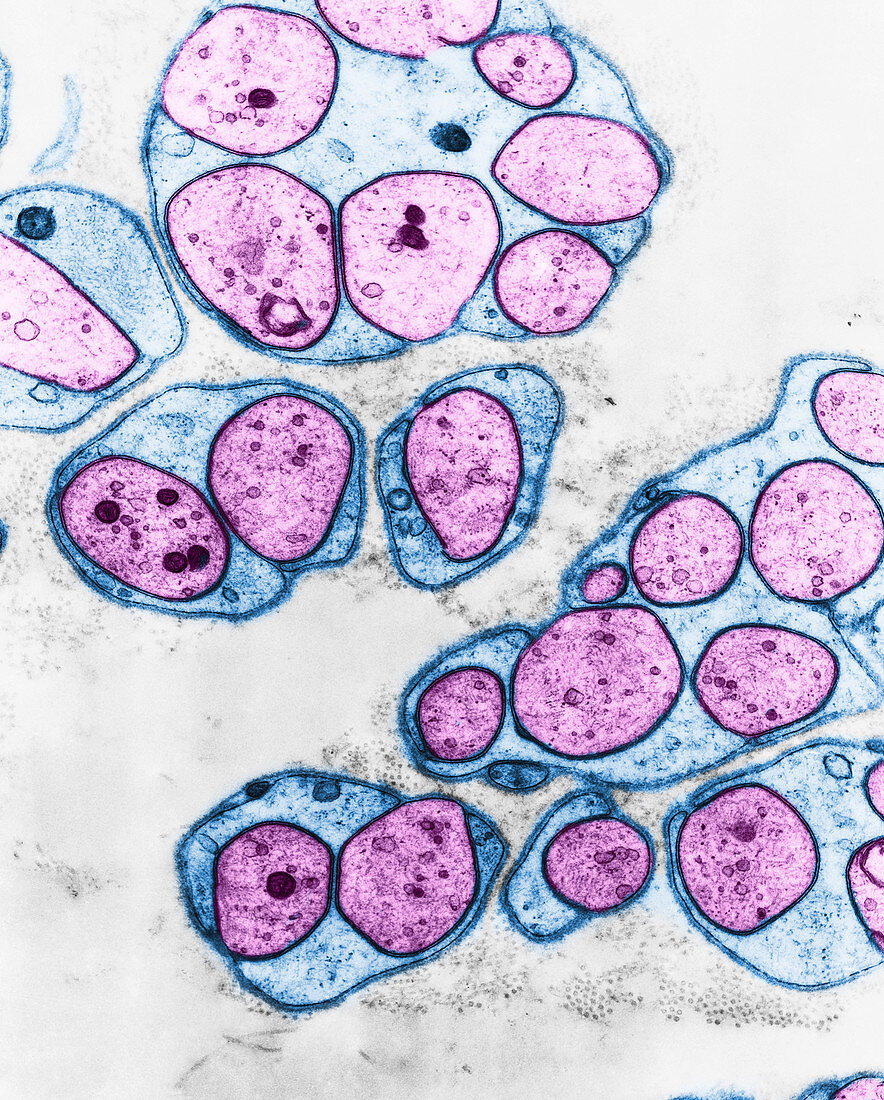 Unmyelinated Nerve Fibres (TEM)