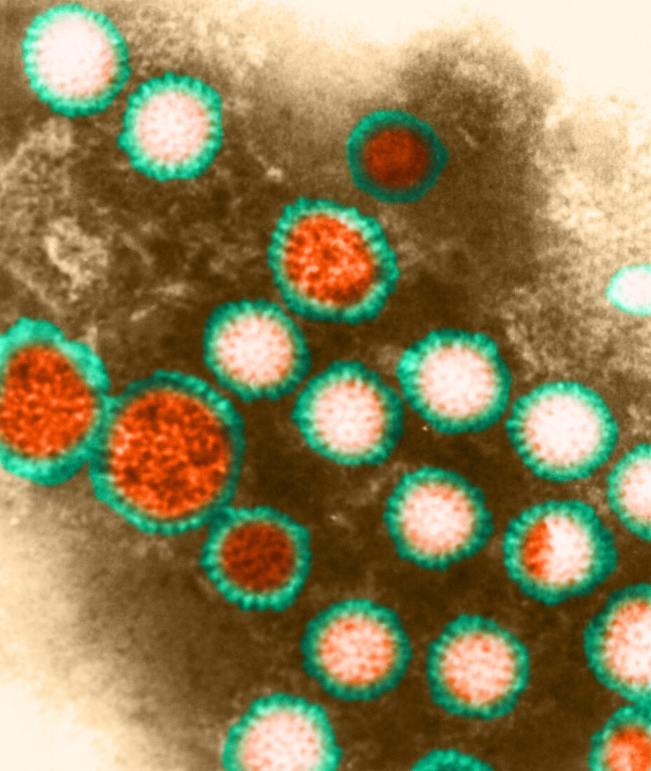 Rotavirus (TEM)