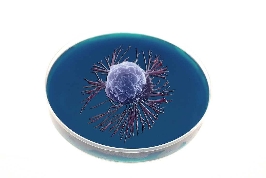 Breast Cancer Cell in a Petri Dish