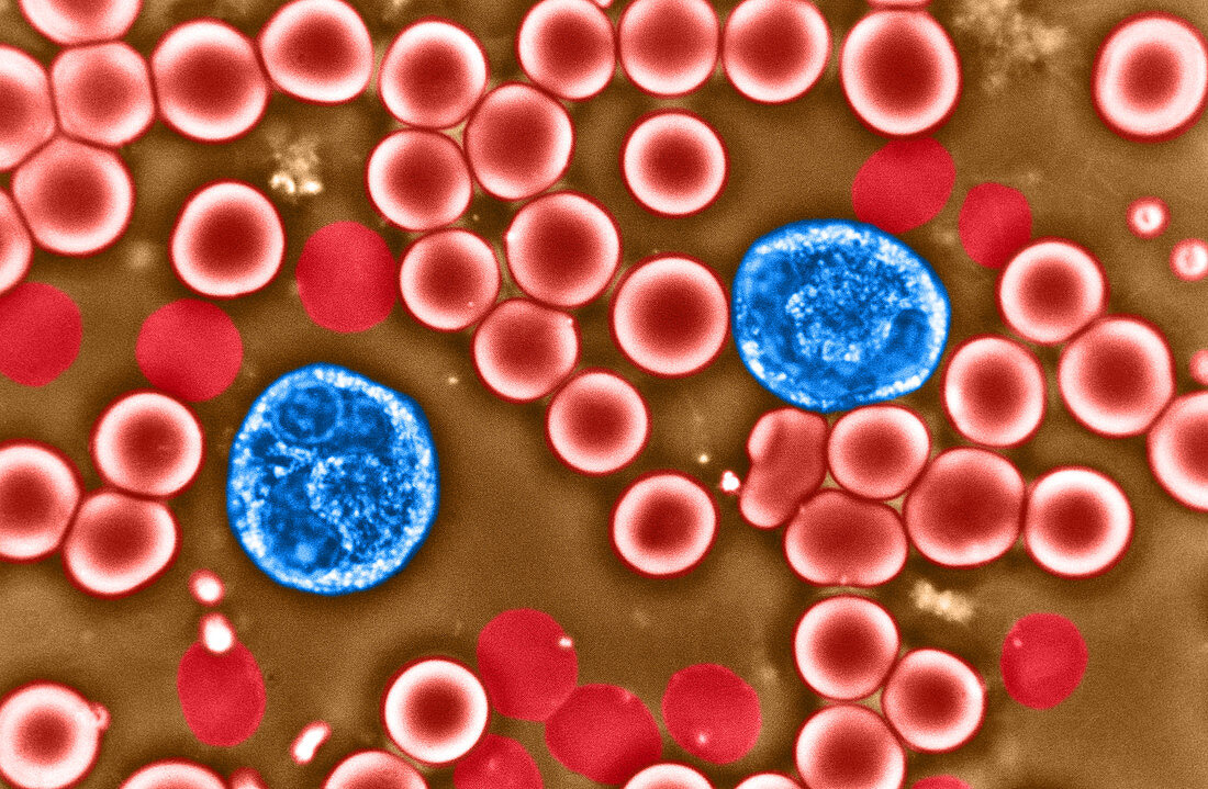 Red and White Blood Cells (LM)